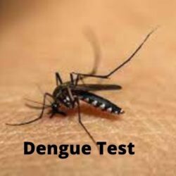 Dengue Profile - Rapid